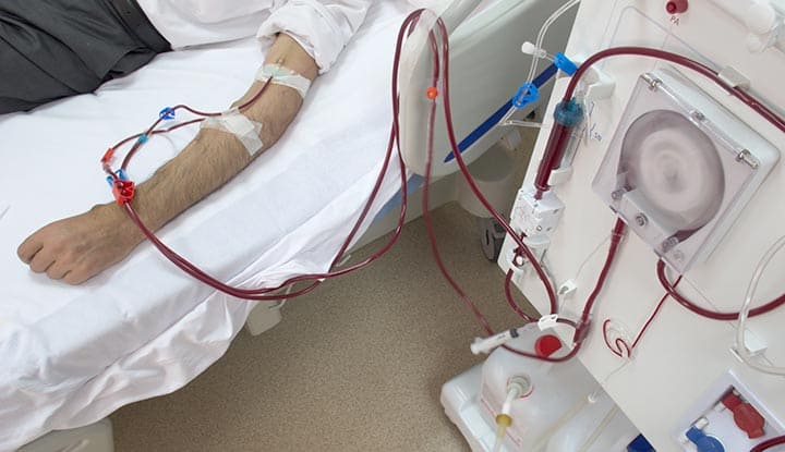 Dialysis in Sevayan Hospital Munger Bihar
